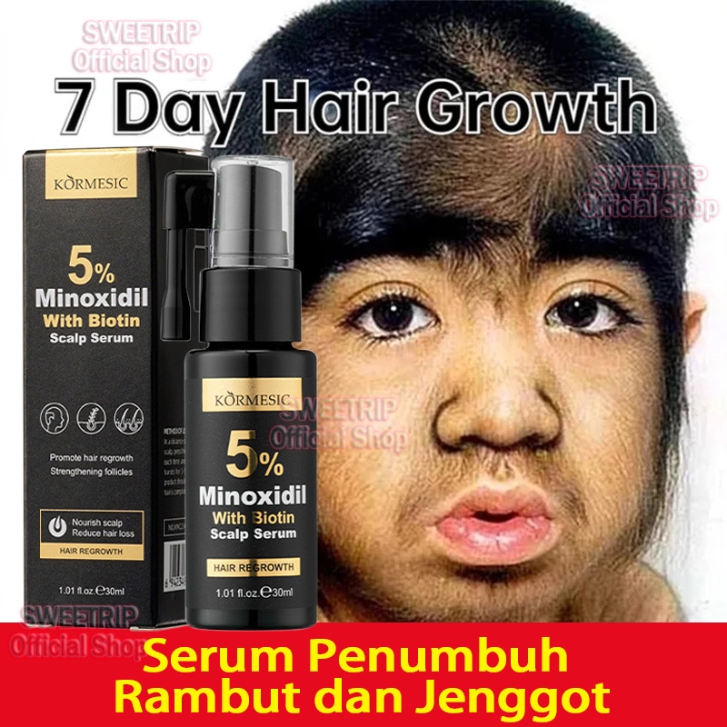 Hair Serum Minoxidil Penumbuh Rambut Serum Penumbuh Rambut Cepat Dan Tebal Penumbuh Rambut Obat Ramb