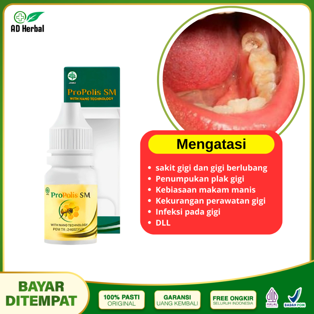 Obat Sakit Gigi Berlubang Penghancur Gigi Berlubang Dan Gusi Propolis SM
