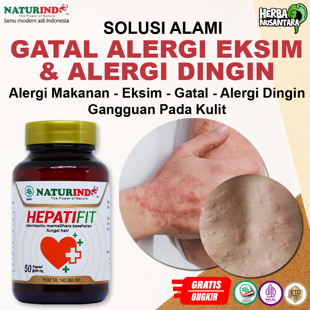 Obat Biduran Alergi Naturindo Dewasa Anak Anak Herbal Alami Ampuh