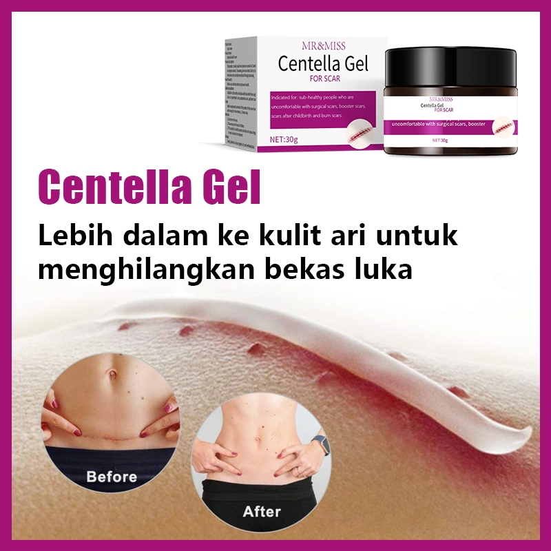 ADY78 Penghilang bekas luka hitam koreng cream penghilang bekas luka salep luka bakar obat koreng