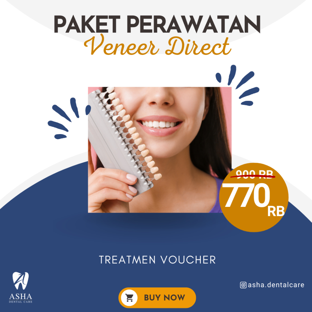 Paket Perawatan Veneer Gigi