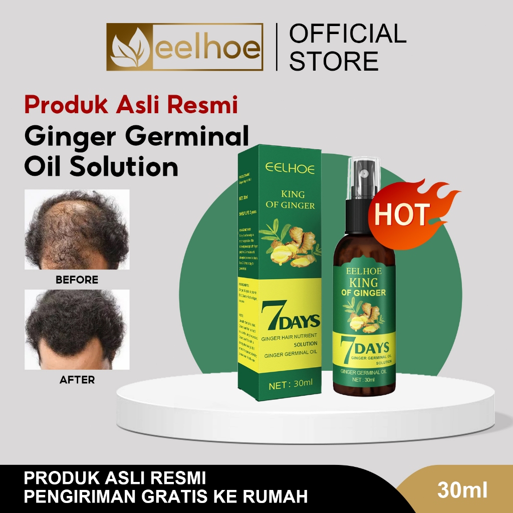 EELHOE 【100%ORI/COD 】King Of Ginger 7 Days Original Hair Growth Serum Spray30g Ginger Germinal Oil|S