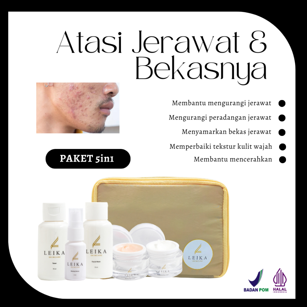 PAKET 5in1 Penghilang Jerawat Dan Bekas Jerawat Bpom Penghilang Jerawat Pria Leika Skincare Halal MU