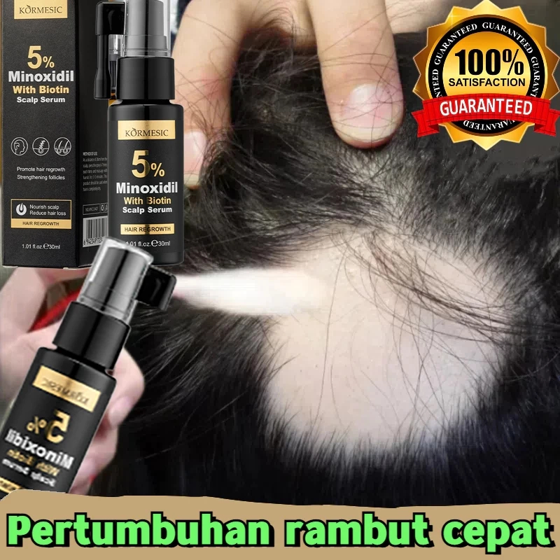 Minoxidil Original 100% Minoxidil Penumbuh Rambut Obat Penumbuh Rambut Botak, Tipis Dan Rontok Super