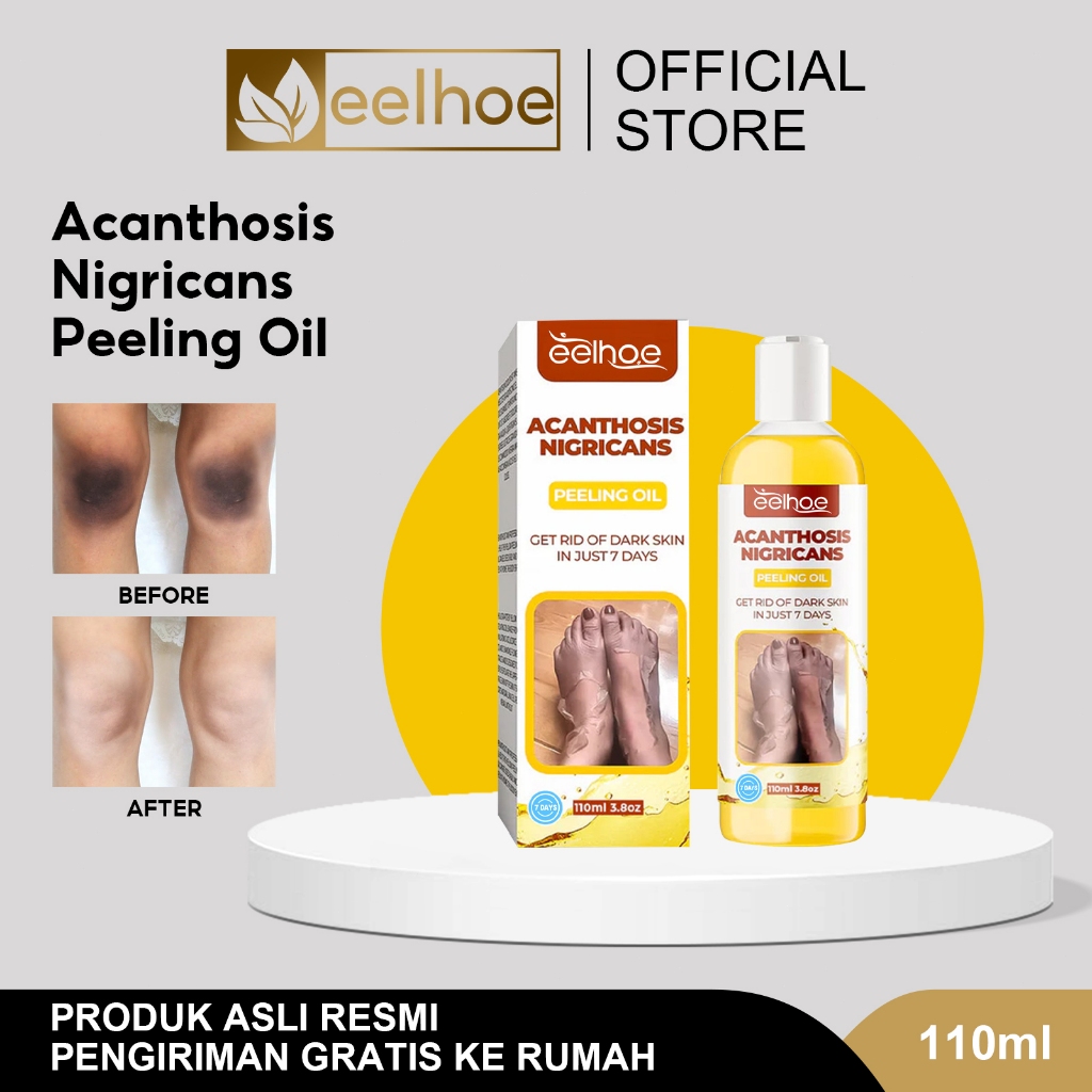 EELHOE Acanthosis Nigricans Peeling Oil110ml Minyak Pengelupas Kulit Mati|Minyak Pengelupas Kulit Ba