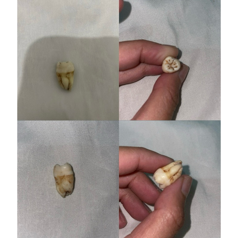 Gigi Geraham Asli / Gigi praktikum / Molar / Pre Molar / Gigi Graham