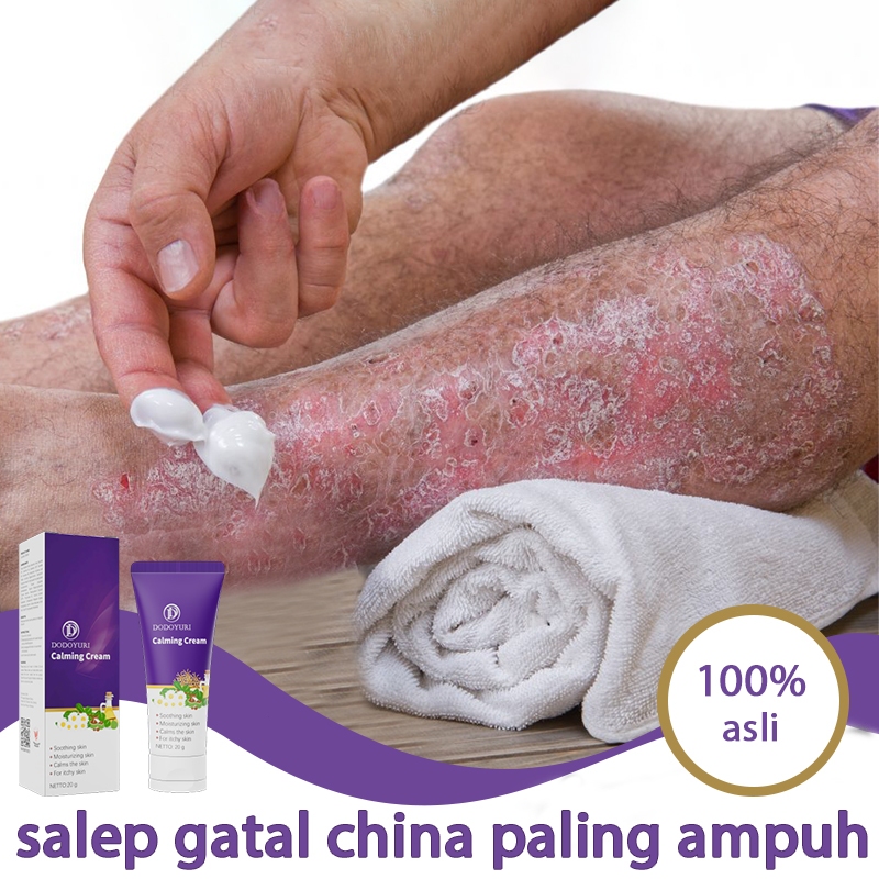 Salep gatal selangkangan salep jamur kulit paling ampuh obat kurap 20g obat gatal selangkangan salep