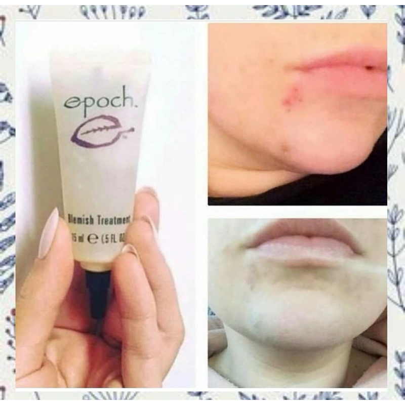 

Obat totol jerawat Blem_ish 5mL