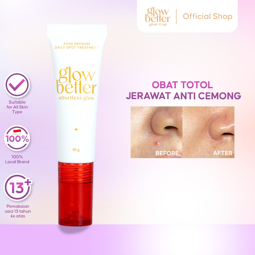 Glow Better Effortless Glow Acne Defense Daily Spot Treatment 10gr - Skincare untuk Menghilangkan Je