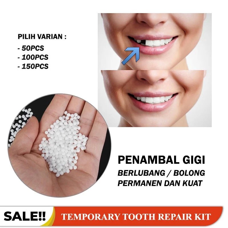 GIGI PALSU SEMENTARA / PENAMBAL GIGI PATAH RENGGANG TEMPORARY TOOTH TEMPTOOTH GINGSUL PATAH KELINCI