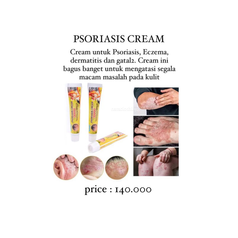 PSORIASIS CREAM
