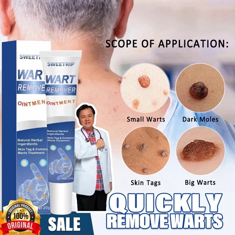 Menghilangkan Kutil Tahi Lalat Penghilang Tahi Lalat Penghilang Kutil Dan Tahi Lalat