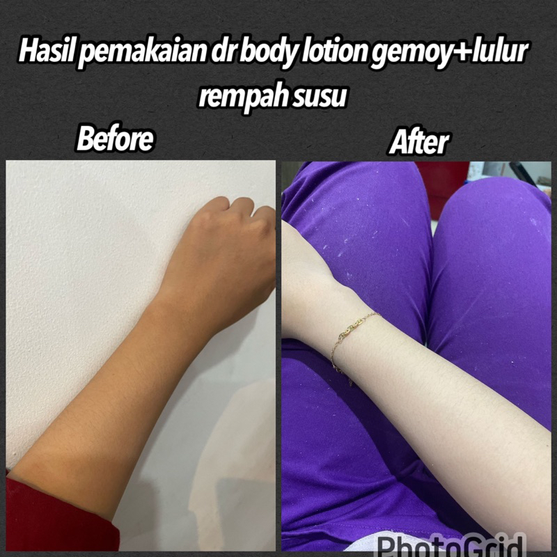 HB whitening booster