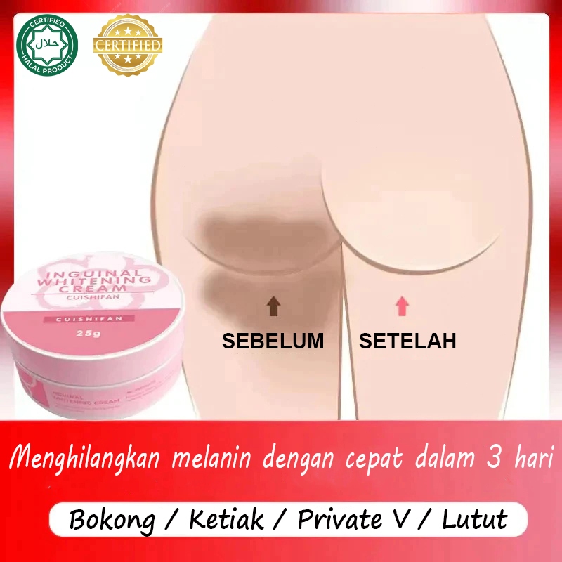 Pemutih miss v Pemutih selangkangan Memutihkan selangkangan hitam Pencerah selangkangan 30g Pemutih 