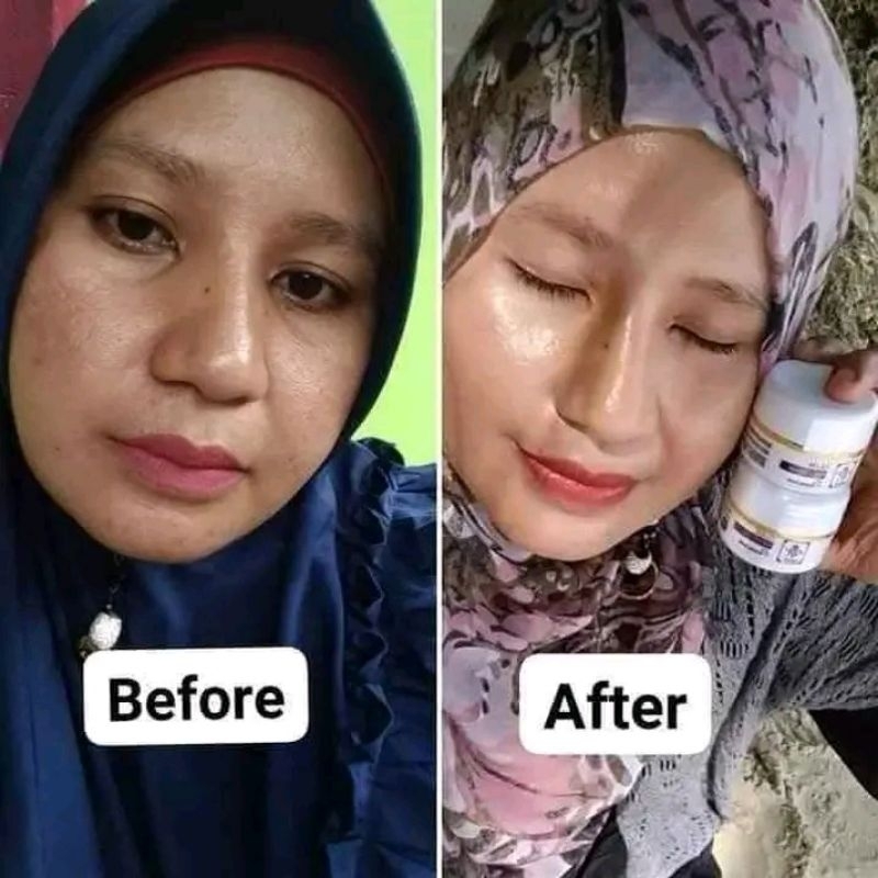 PAKET RK GLOW PREMIUM