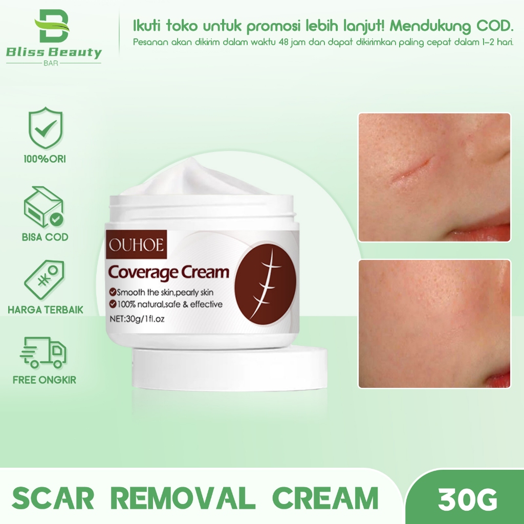 OUHOE Scar Removal Cream 30g Obat Cream Penghilang Bekas Luka Koreng Scar Repair Cream Obat Penghila