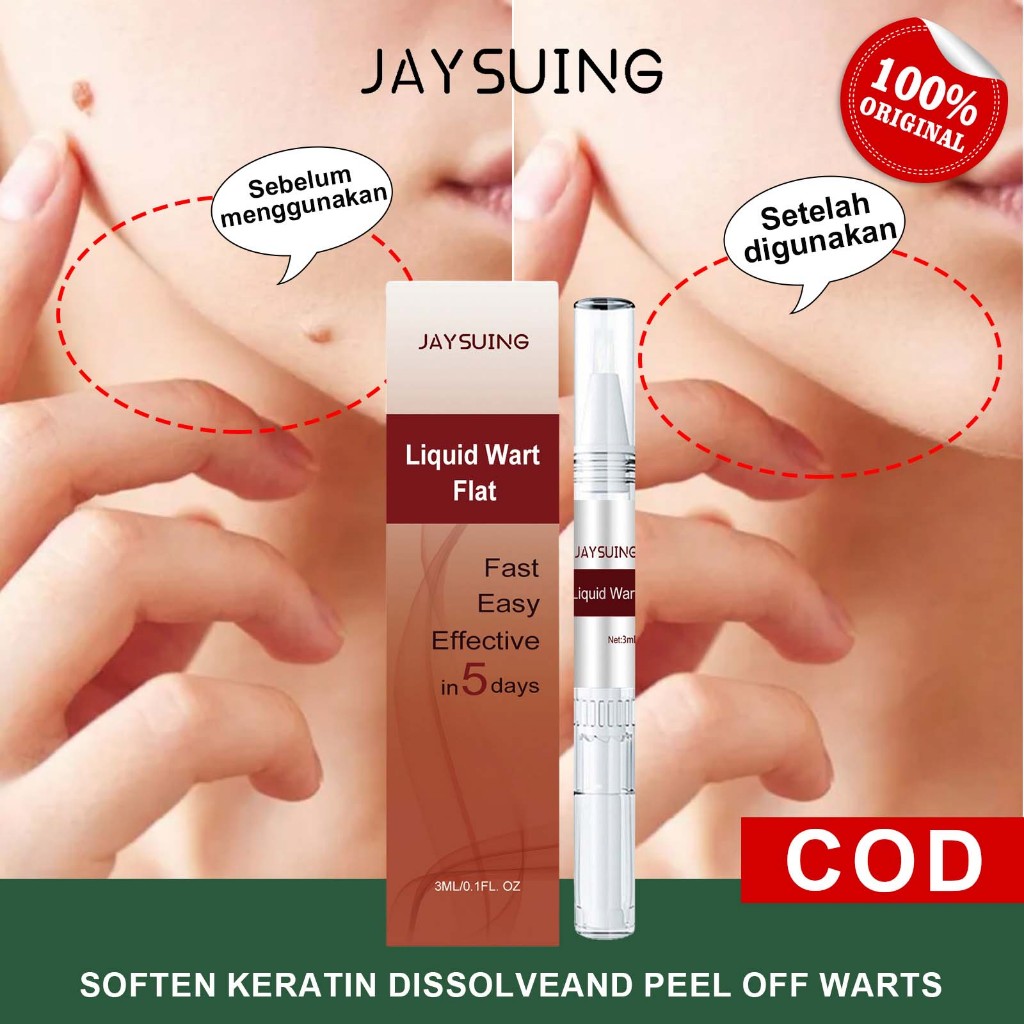 [Beli 2 Gratis 1/ORI] Jaysuing Pena Penghilang Kutil 3ml Penghilang Kutil Dan Tahi Lalat Liquid Wart