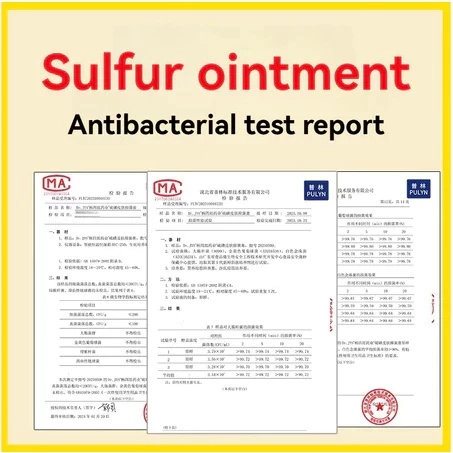 Salep Gatal China Paling Ampuh Salep Gatal Jamur Selangkanga Krim Eksim Bayi Dan Anak Obat Gatal