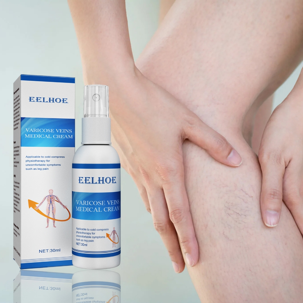 EELHOE 30ml Semprotan Pijat Vena Varises Varises Vena Kaki Cacing Tanah Benjolan Pembuluh Darah Semp