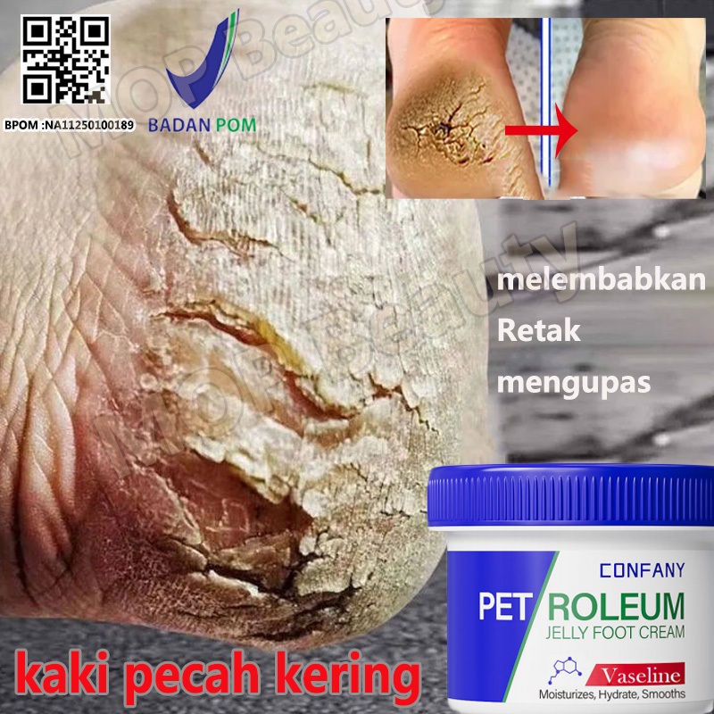 Krim Perbaikan Pecah cream kaki pecah dan krim kaki foot cream krim kaki obat kaki pecah pecah Tanga