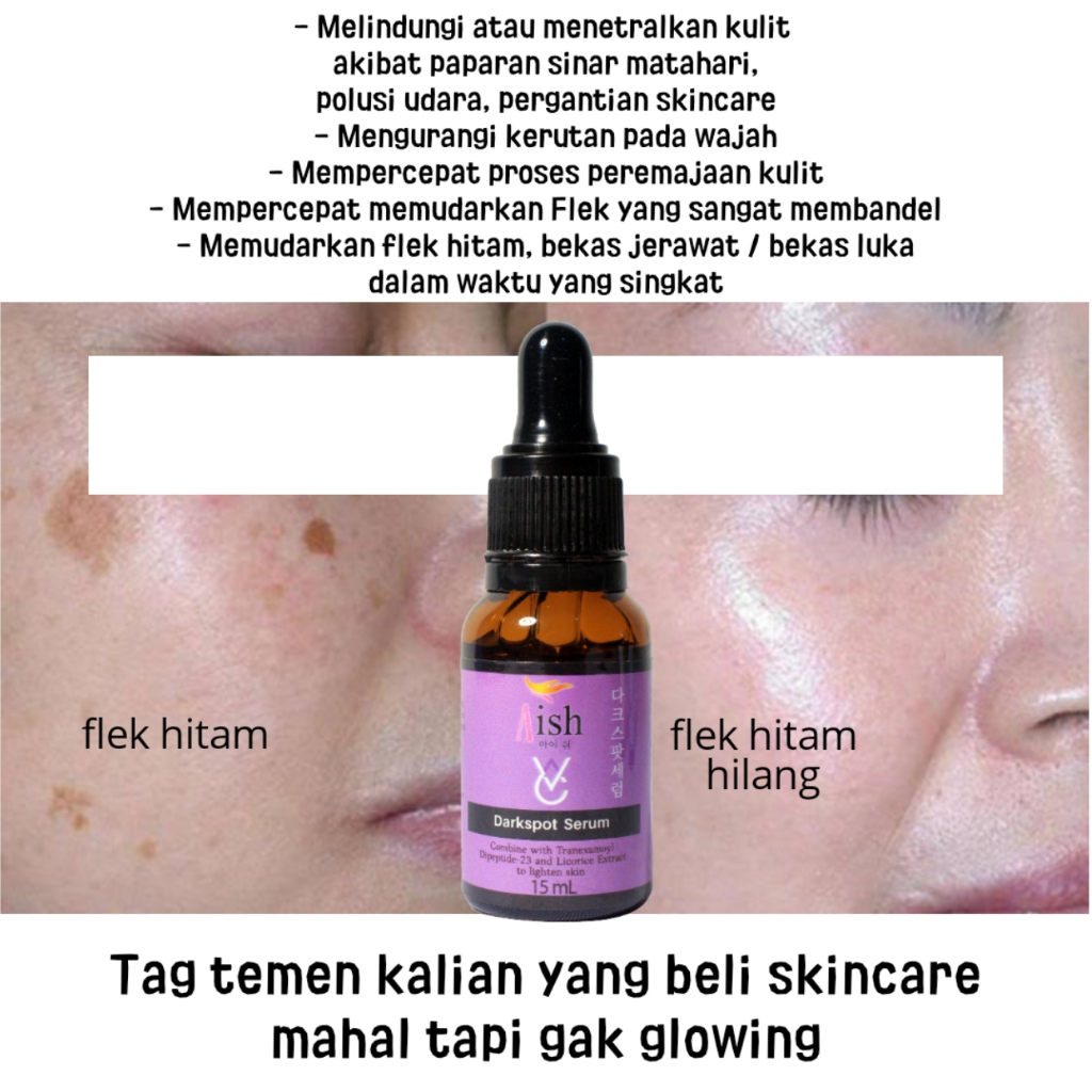 Aish serum Darksport menghilangkan Flek Hitam Original Bpom | Serum Aish Darkspot | Original serum |
