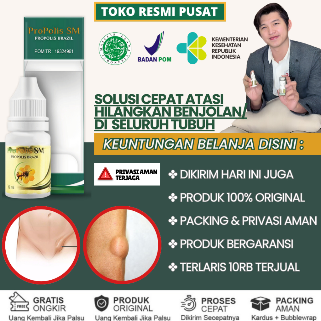 Obat Benjolan Selangkangan, Obat Penghancur Benjolan di Selangkangan, Obat Hilangkan Benjolan, Obat 