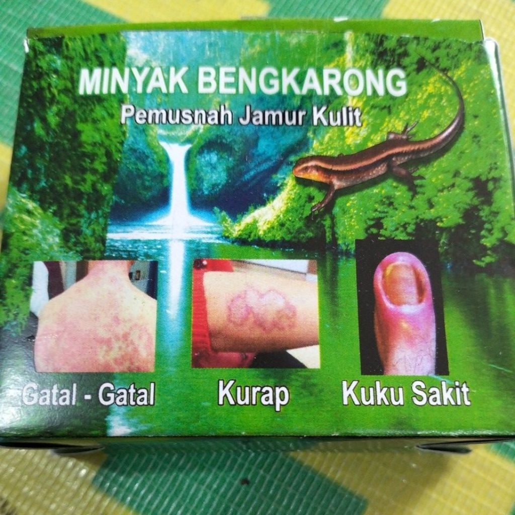 

Minyak Bengkarong PemUsna Jamur Kulit 1 Kota isi 3 BotoL
