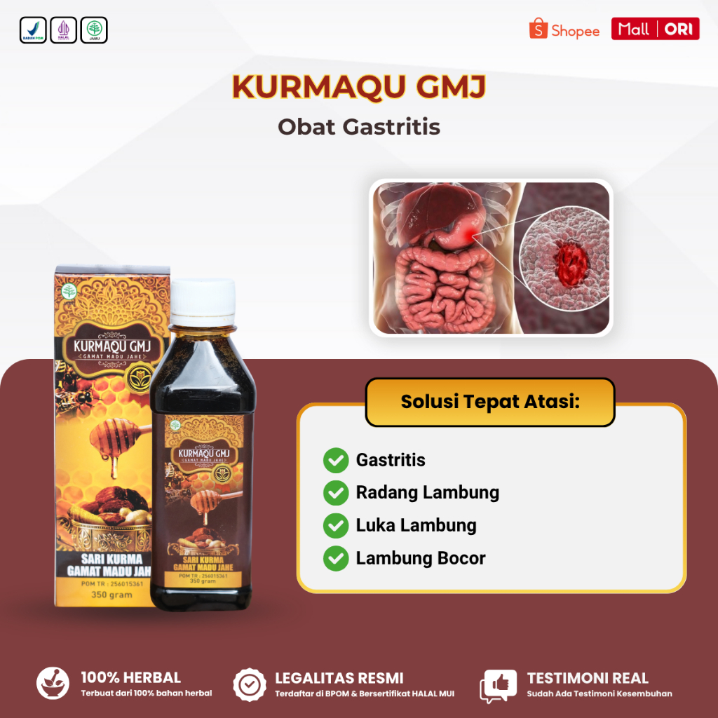 Obat Gastritis, Radang Lambung, Luka Lambung, Lambung Bocor, Pendarahan Lambung - Kurmaqu GMJ