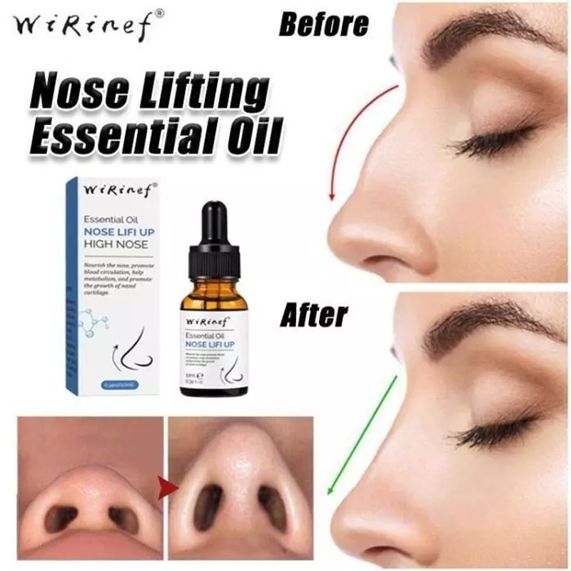 Wirinef Serum Pemancung Hidung Permanen Original Asli/Alat Pemancung Hidung/Penjepit Hidung/Hidung M