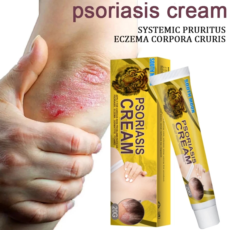 South Moon Salep Gatal Paling Ampuh Salep Jamur Kulit gatal Salep Eksim Salep Kulit Krim Psoriasis P