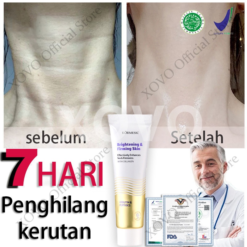 pemutih leher paling ampuh bpom 50g Krim pemutih pencerah pengencang leher neck cream lifting pemuti