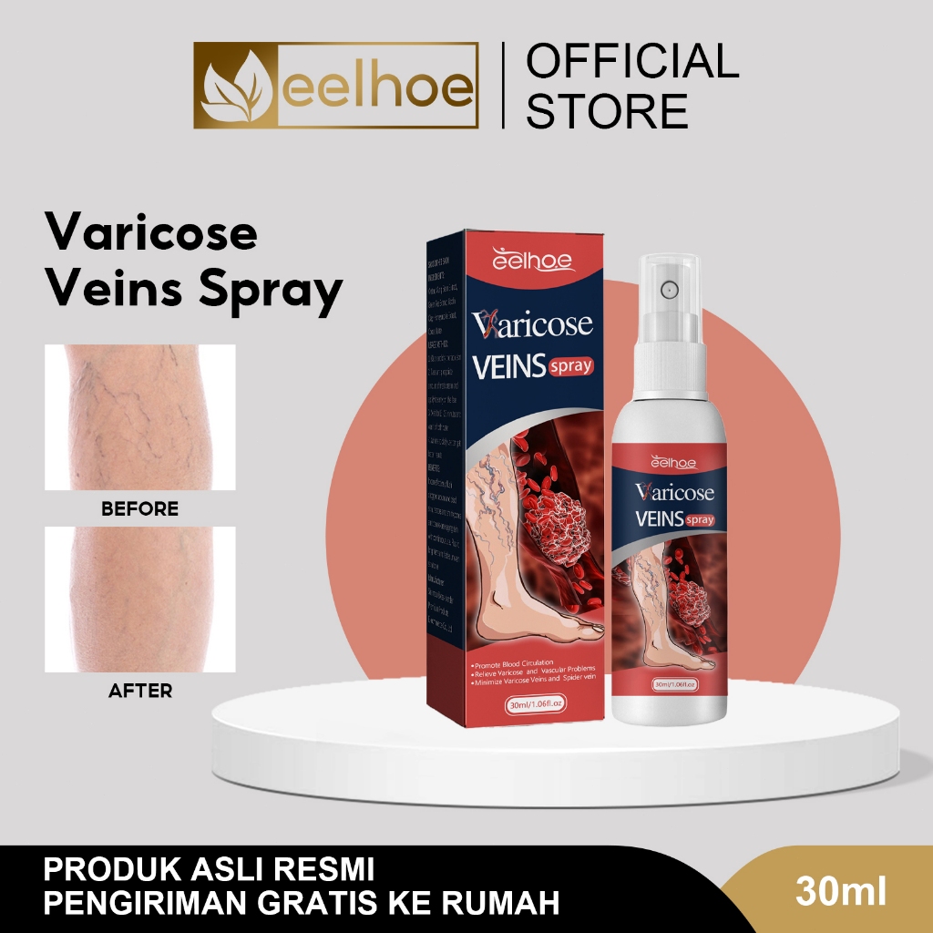 EELHOE Varicose Vein Spray30ml Semprotan Pijat Vena|Semprotan Varises Kaki|Menghilangkan Varises Kec