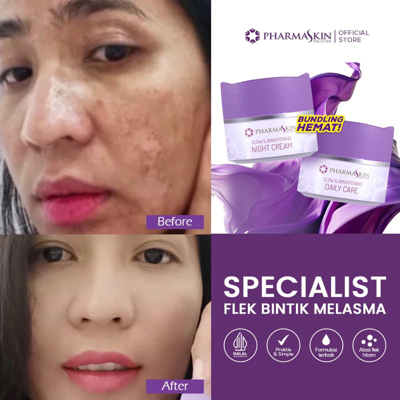 Cream Malam Flek Hitam Membandel / Siang Malam / Pharmaskin Solution / Cream Siang Malam Flek