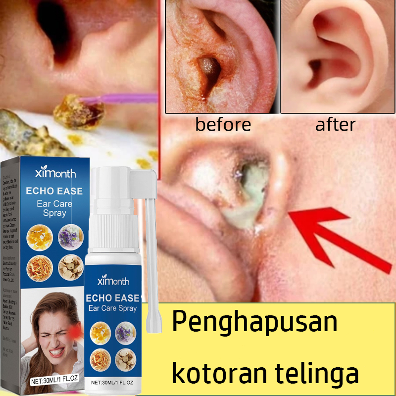 Obat Tetes Telinga Pembersih Telinga Obat Penyumbat Telinga Semprotan Tinnitus Pengobatan Sakit Teli