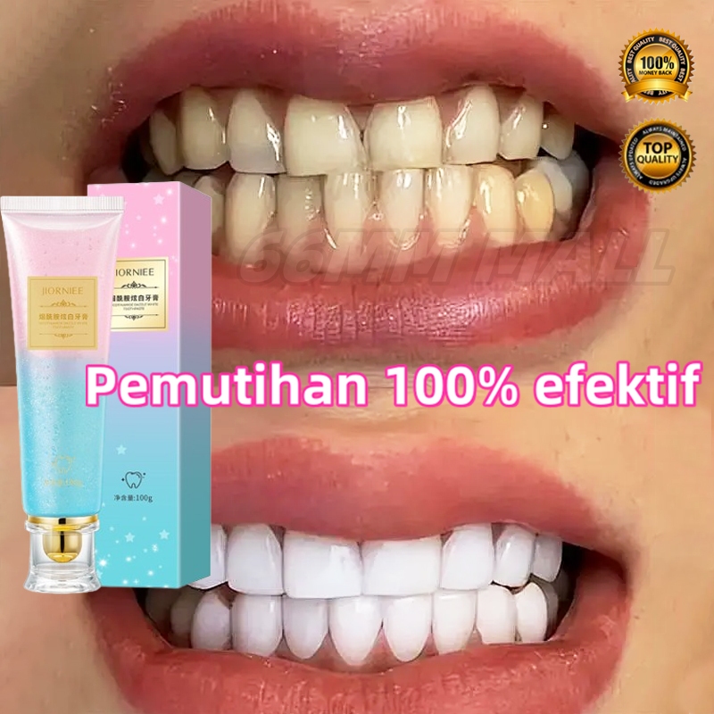 odol pemutih gigi 100g pasta gigi pemutih gigi kuning permanen cepat bodyaccel pasta gigi Pasta Gigi
