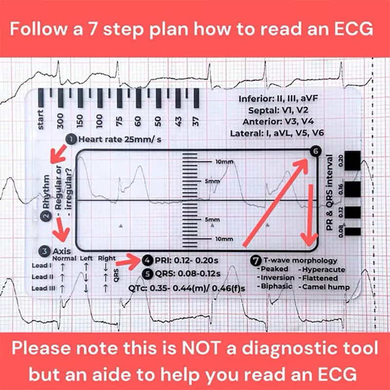 

Penggaris medis kedokteran ECG 7 Step Ruler 7 Step Scale for ECG Observation Portable Transparent 7step Ruler Measurement Tool Ruler for ECG Interpretation