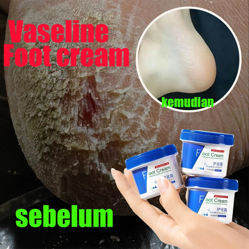 Vaseline Kaki Pecah Dan Kering Foot Cream Krim kaki Obat Kaki Pecah Pelembab kaki keringdan pecah Pe
