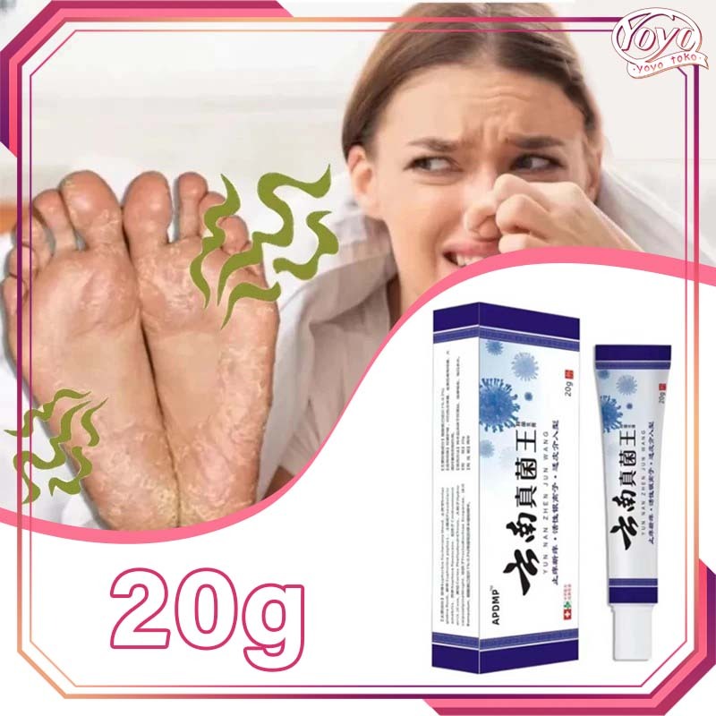 Kaki Rayapan Dan Bau Obat Kaki Kapalan Obat Kaki Rayap Salap Kaki Rayapan Paling Efektif