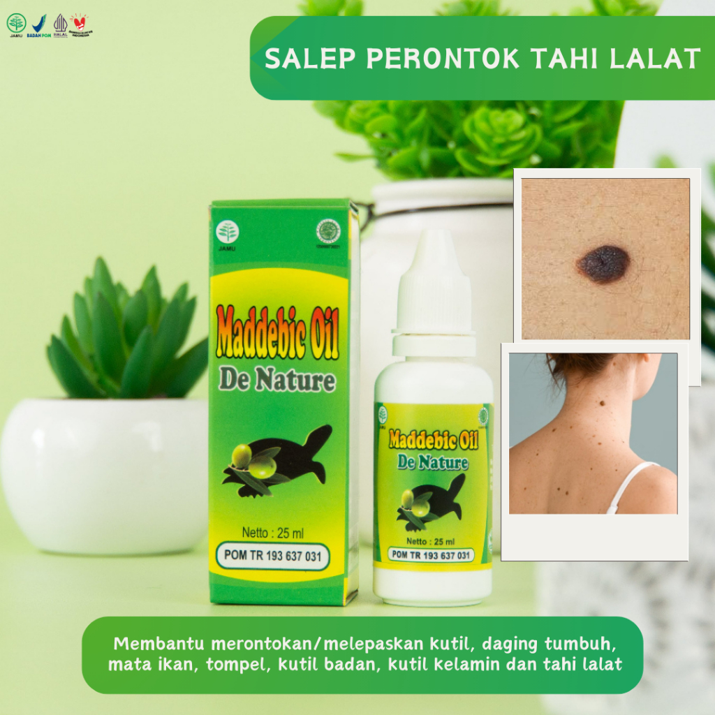 MADDEBIC Untuk Pembersih Melanoma DAN Tanda Lahir, Penghilang Noda Hitam Di Muka, Hemangioma, Salep 