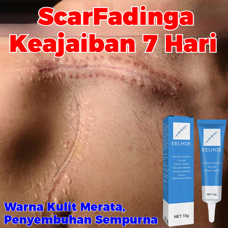 Krim penghilang bekas luka dan gel penghilang bekas luka sangat cocok untuk menghilangkan bekas luka