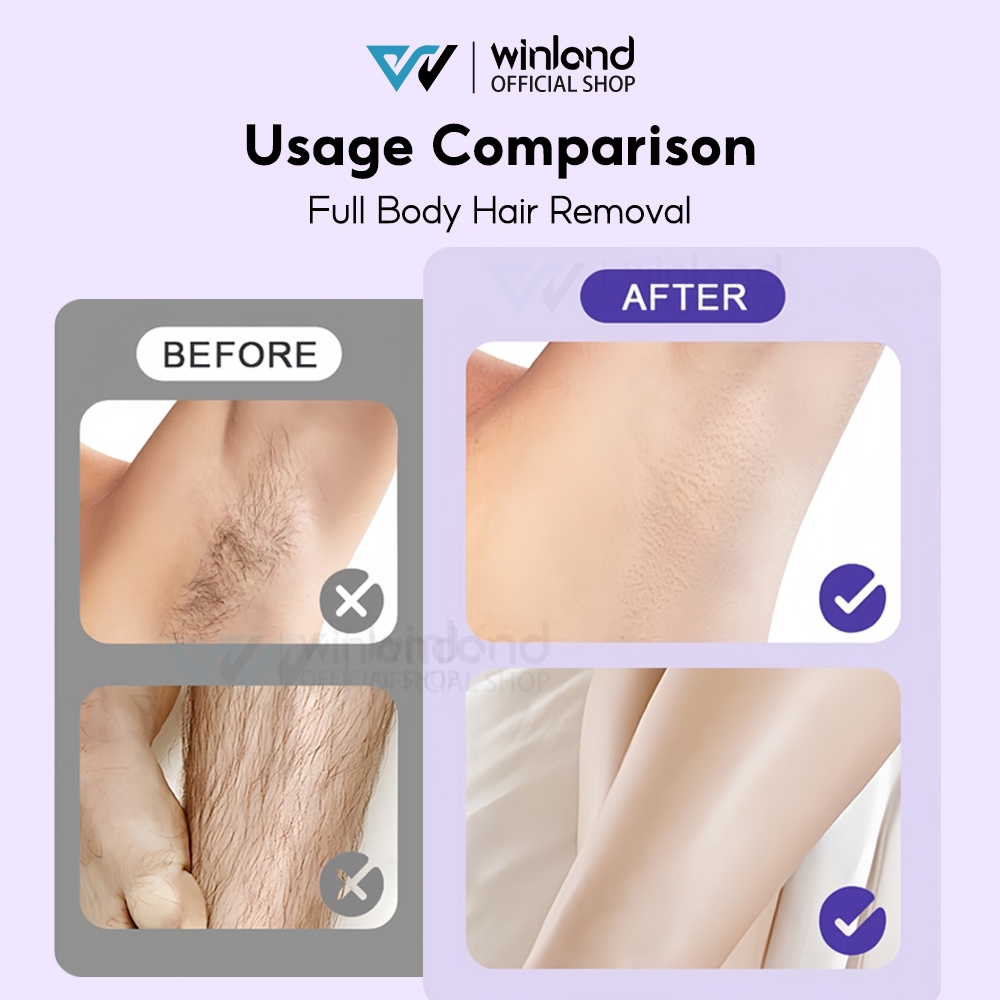 Winland Alat Cukur Wanita Alat cukur bulu Pencukur Bulu Alat Cukur Bulu Kemaluan Mini Epilator