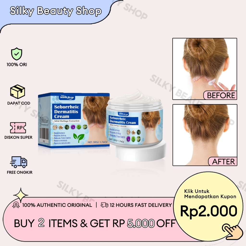 [Beli 2 Gratis 1] South Moon Seborrheic Dermatitis Cream 50g Seborrheic Skin Cream Krim Obat Kulit K