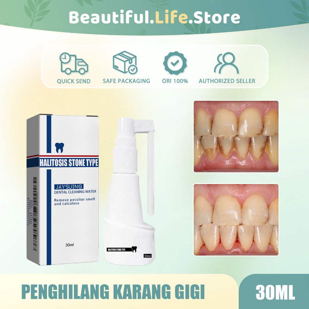 100%ORI/COD-Penghilang Karang Gigi 30ml Gigi Penghilang Karang/Penghilang Karang Gigi Paling Ampuh/A