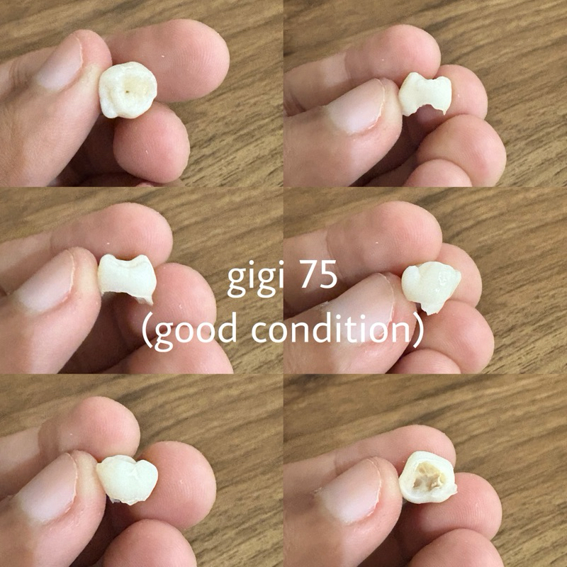 Gigi Praktikum Asli - Gigi Asli Sulung / Gigi Anak