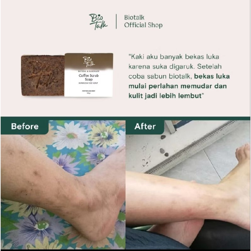 [Ready Stok] Biotalk Coffe Scrub Soap untuk memudarkan bekas luka