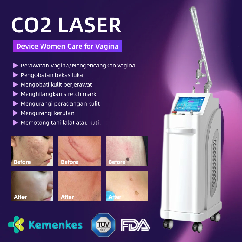Fractional CO2 Laser 4D co2 laser stretch mark penghilang bekas luka laser bekas jerawat laser scar