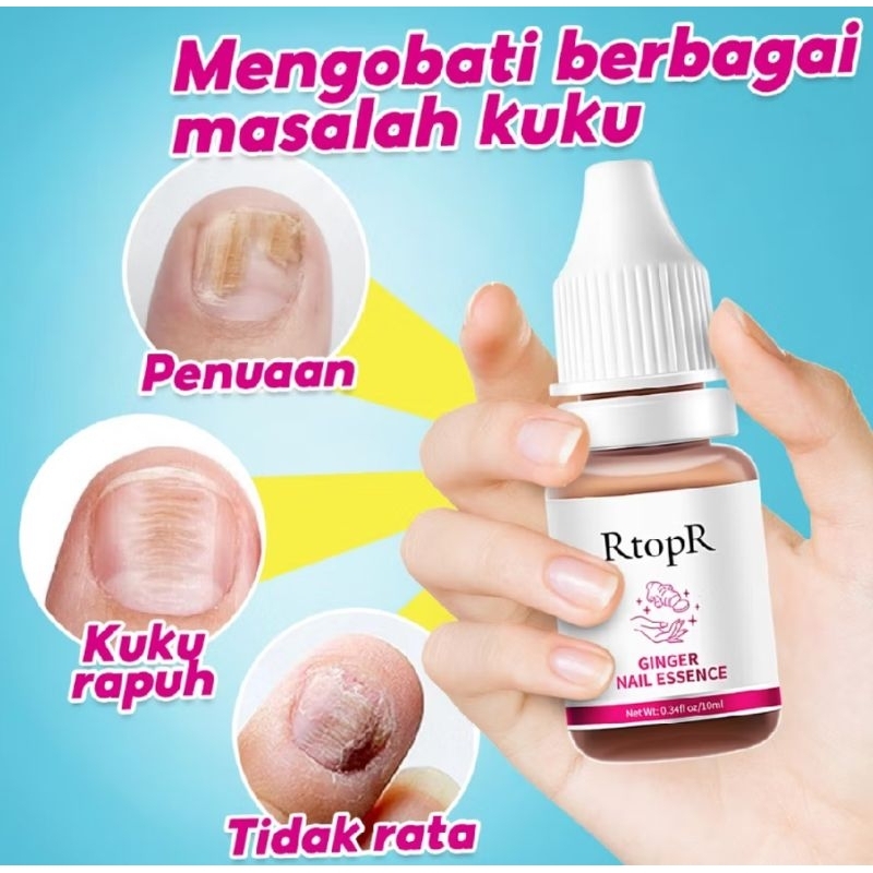 PROMO RTOPR OBAT KUKU/MEMPERBAIKI KUKU BERMASALAH