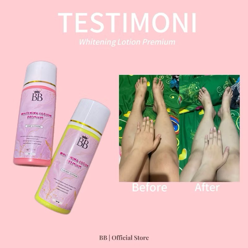 Hb Dosting Platinum Handbody Pemutih Badan Dosting Tinggi / Hb Booster10x Lebih Cepat
