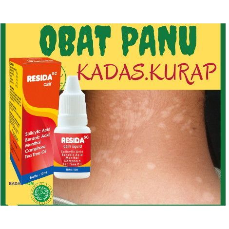 RESIDA SC CAIR Obat Gatal Kulit Obat Panu Obat Kadas Obat Kurap Obat Kutu Air