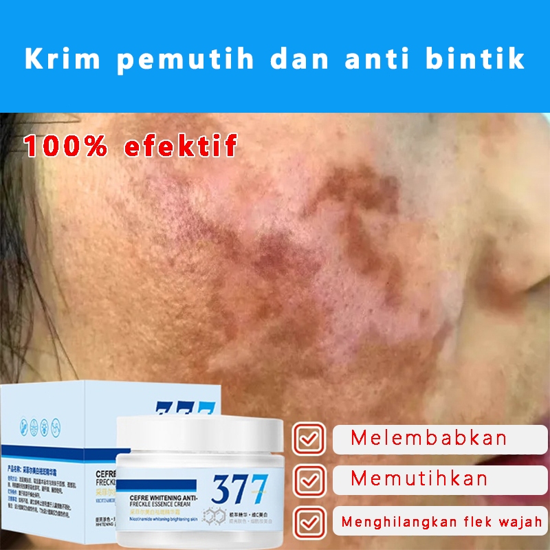 Krim penghilang flek hitam, krim penghilang dan pemutih bintik, krim flek hitam membandel, krim flek